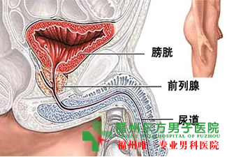 前列腺炎病因