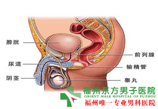 预防精子畸形的措施有哪些?