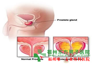 得了阴虱会出现什么症状?