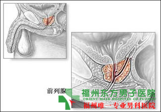 无精症的诊断