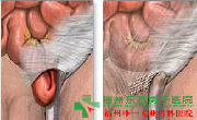 前列腺炎肥大检查?