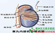 睾丸炎治疗费用