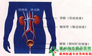 泌尿感染原因