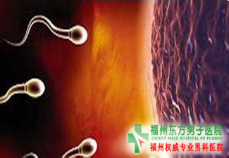 男性精索静脉曲张是怎么回事