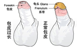 做包皮手术多少钱?